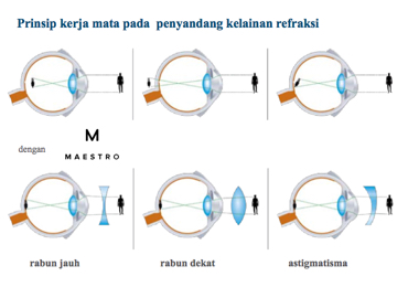 clear lens